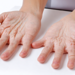 découvrez les conseils surprenants d'une dermatologue pour dire adieu aux mains gercées et retrouver une peau douce, hydratée et impeccable au quotidien.