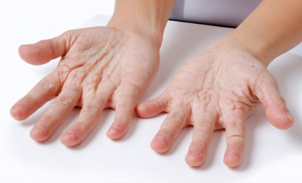 découvrez les conseils surprenants d'une dermatologue pour dire adieu aux mains gercées et retrouver une peau douce, hydratée et impeccable au quotidien.