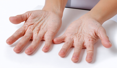 découvrez les conseils surprenants d'une dermatologue pour dire adieu aux mains gercées et retrouver une peau douce, hydratée et impeccable au quotidien.